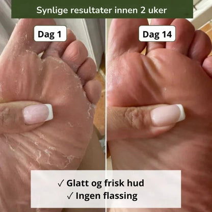 NORDESTO™ Anti-Pilz Seife — Tägliche Pflege gegen Nagelpilz